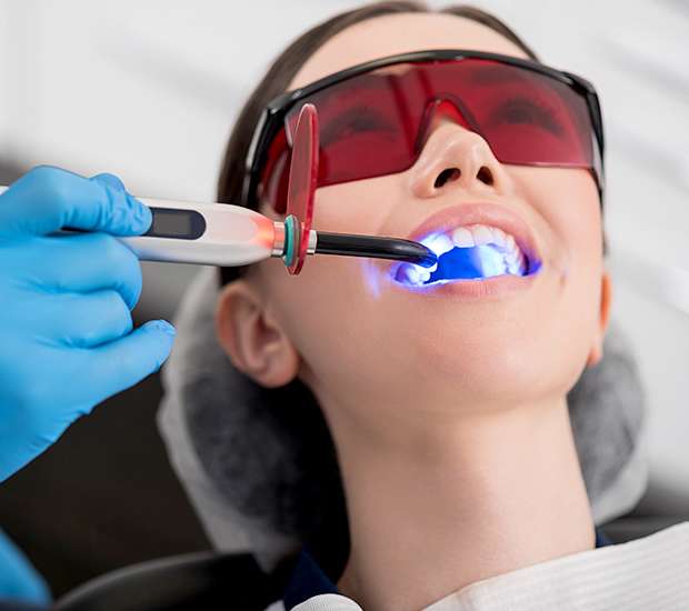 Tucson Professional Teeth Whitening